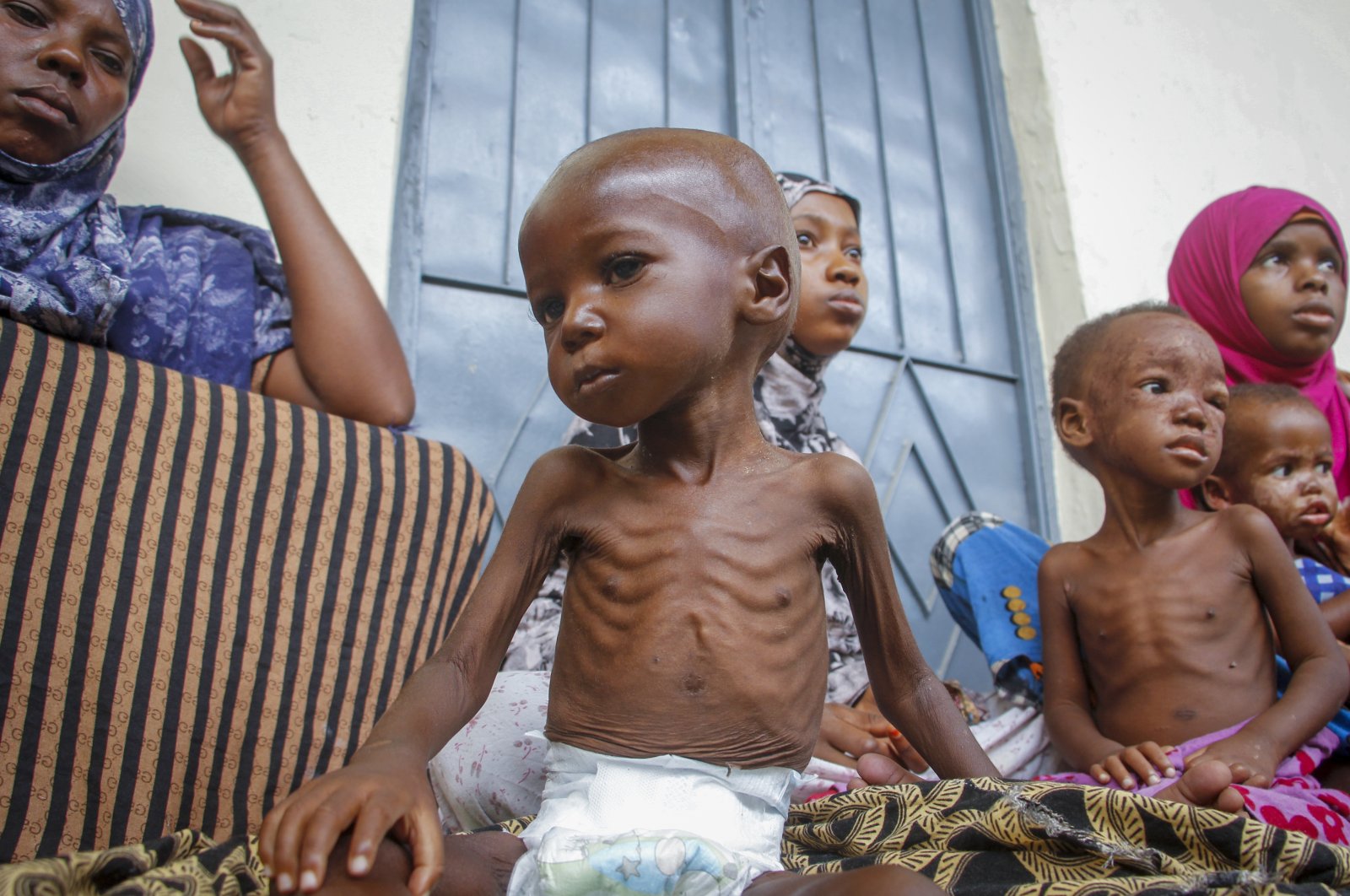 A malnourished 2-year-old sits by his mother (L), who was recently displaced by drought, at a malnutrition stabilization center run by Action Against Hunger, Mogadishu, Somalia, June 5, 2022. (AP Photo)