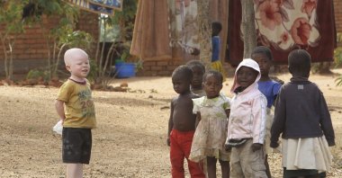 Cassim Jaffalie, 3, who has albinism, stands with his friends at their family home, in Machinga about 200 kilometers (125 miles) northeast of Blantyre, Malawi, May 23, 2016. (AP Photo)