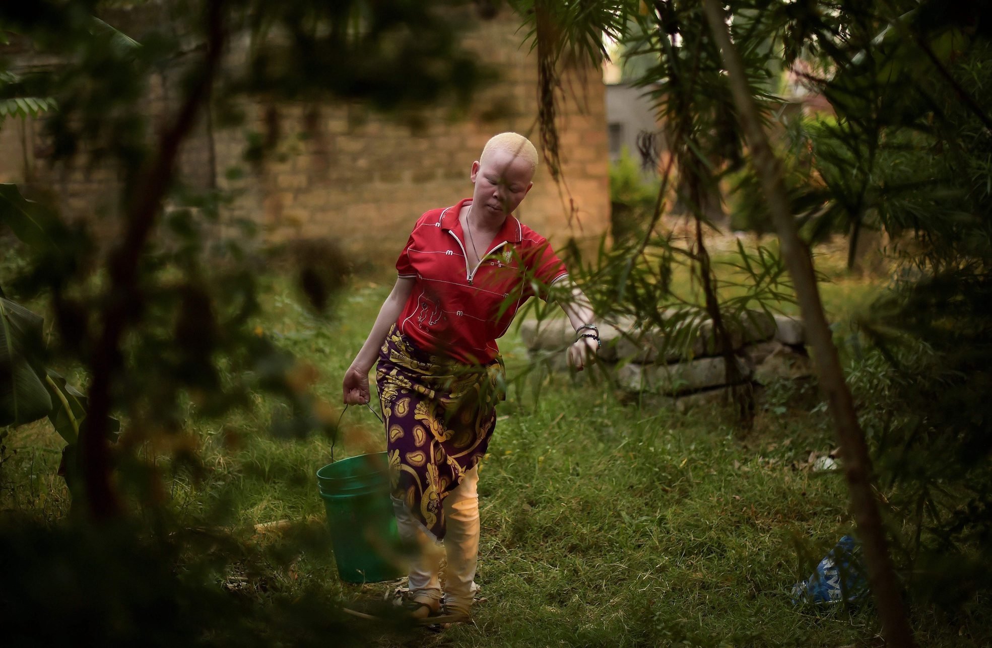 Seorang wanita dengan albinisme mengambil air di Pulau Ukerewe, Danau Victoria, Tanzania, 14 Juni 2016. (AFP Photo)