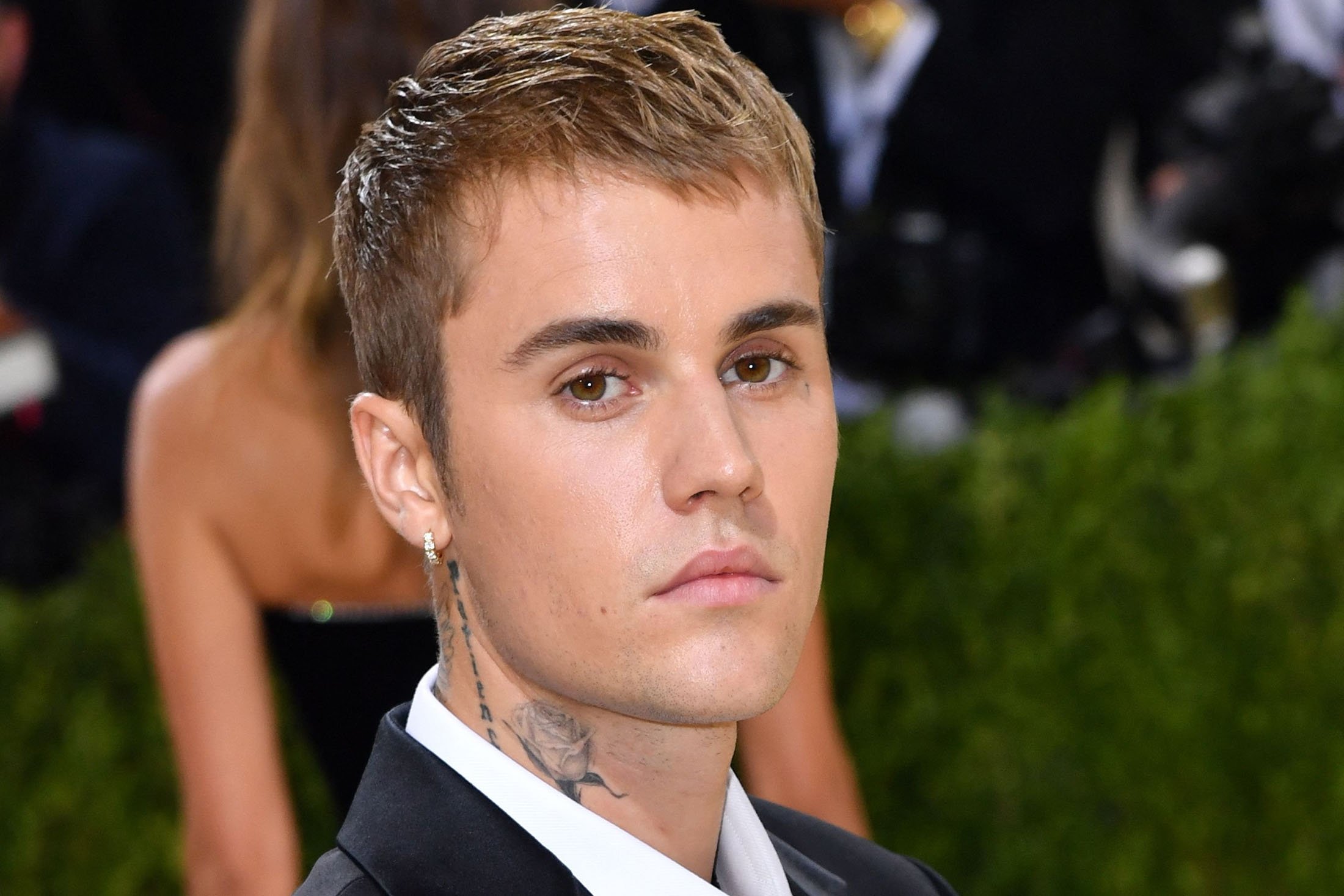 Justin Bieber reveals rare disorder paralysing his face: What is it? | Daily Sabah