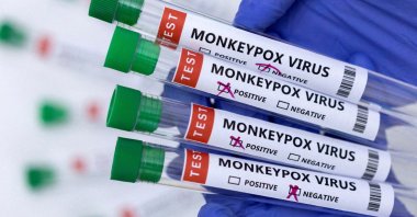 Test tubes labelled "Monkeypox virus positive and negative" are seen in this illustration taken May 23, 2022. (Reuters Photo)