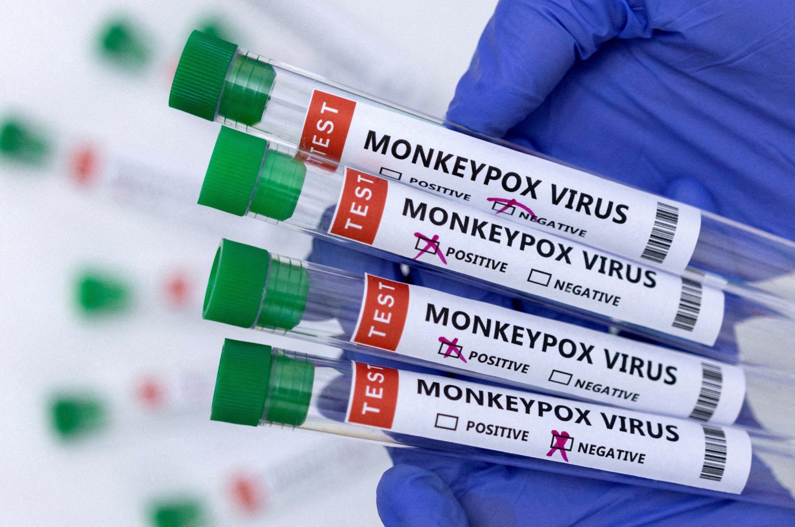Keputusan ‘darurat’ Monkeypox karena dari WHO menarik kritik Afrika