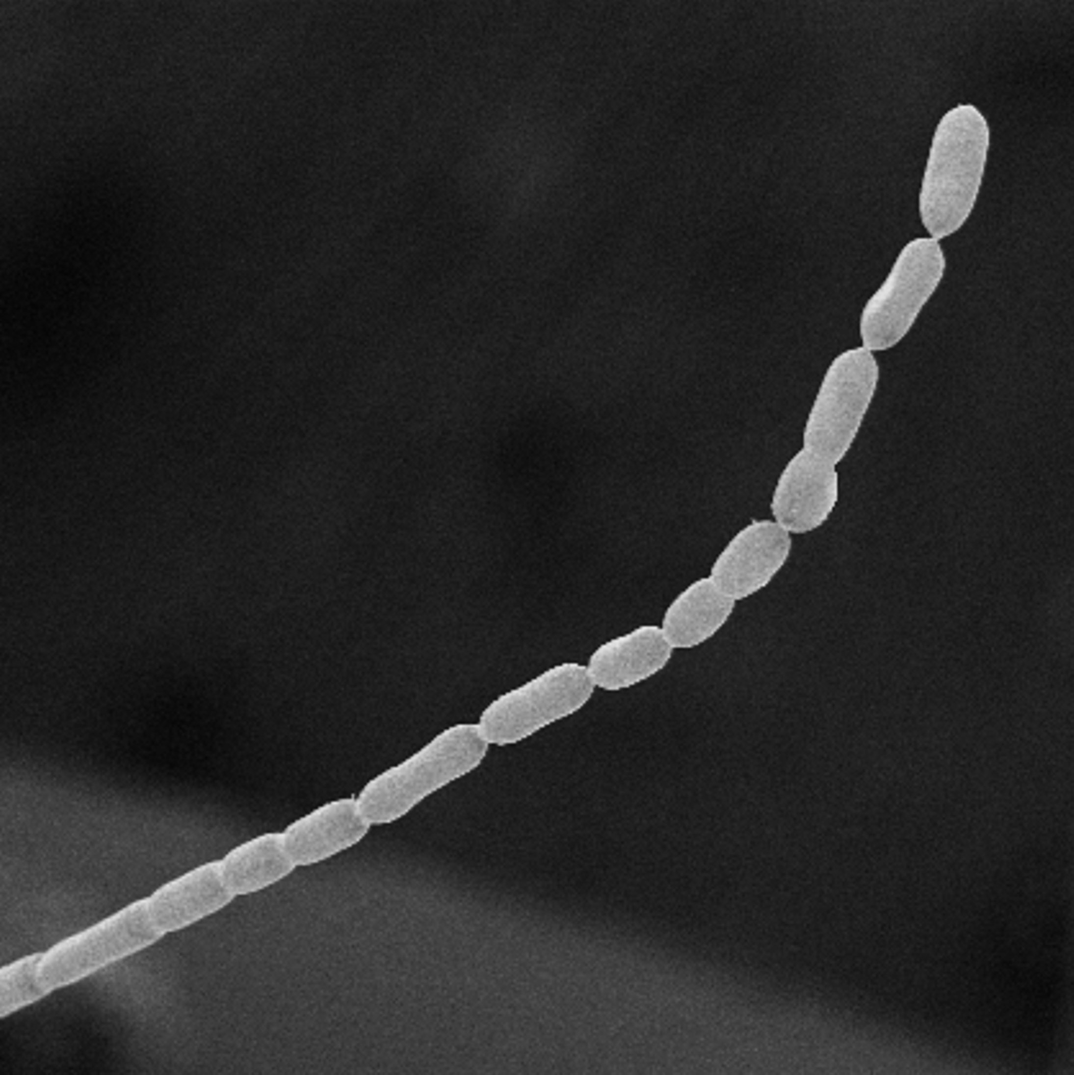 Foto mikroskop yang disediakan oleh Lawrence Berkeley National Laboratory ini menunjukkan untaian tipis sel bakteri Thiomargarita magnifica di sebelah koin recehan AS, California, AS, 21 Juni 2022. (AP Photo)