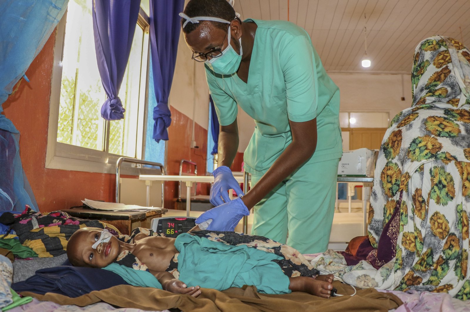 A nurse attends to Mohamed Isack, 2, who is suffering from severe malnutrition after fleeing drought-stricken areas and arriving at the stabilization center of Bay Regional Hospital in Baidoa, Somalia, June 13, 2022. (AP Photo)