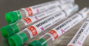 Test tubes labelled "Monkeypox virus positive" are seen in this illustration taken May 22, 2022. (Reuters Photo) 