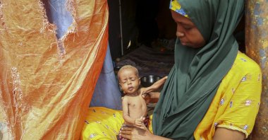 Amina Shuto, 21, who fled the drought-stricken Lower Shabelle area, holds her 2-month-old malnourished child at a makeshift camp for the displaced on the outskirts of Mogadishu, Somalia, June 30, 2022. (AP Photo)