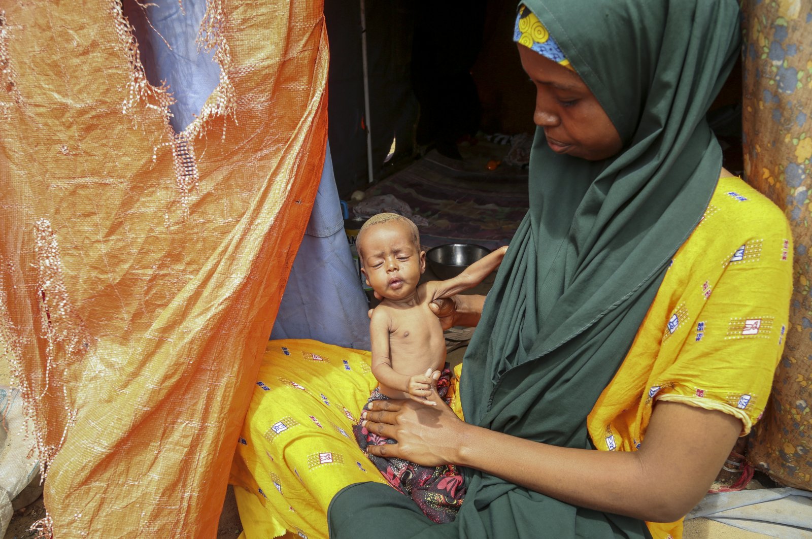 Amina Shuto, 21, who fled the drought-stricken Lower Shabelle area, holds her 2-month-old malnourished child at a makeshift camp for the displaced on the outskirts of Mogadishu, Somalia, June 30, 2022. (AP Photo)