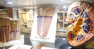 Course materials illustrating the human kidney are displayed in the museum, Ankara, Turkey, June 1, 2022. (AA Photo)