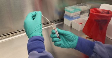 A swab that tested positive for the monkeypox virus is seen at the UW Medicine Virology Laboratory in Seattle, Washington, U.S., July 12, 2022. (AFP Photo)