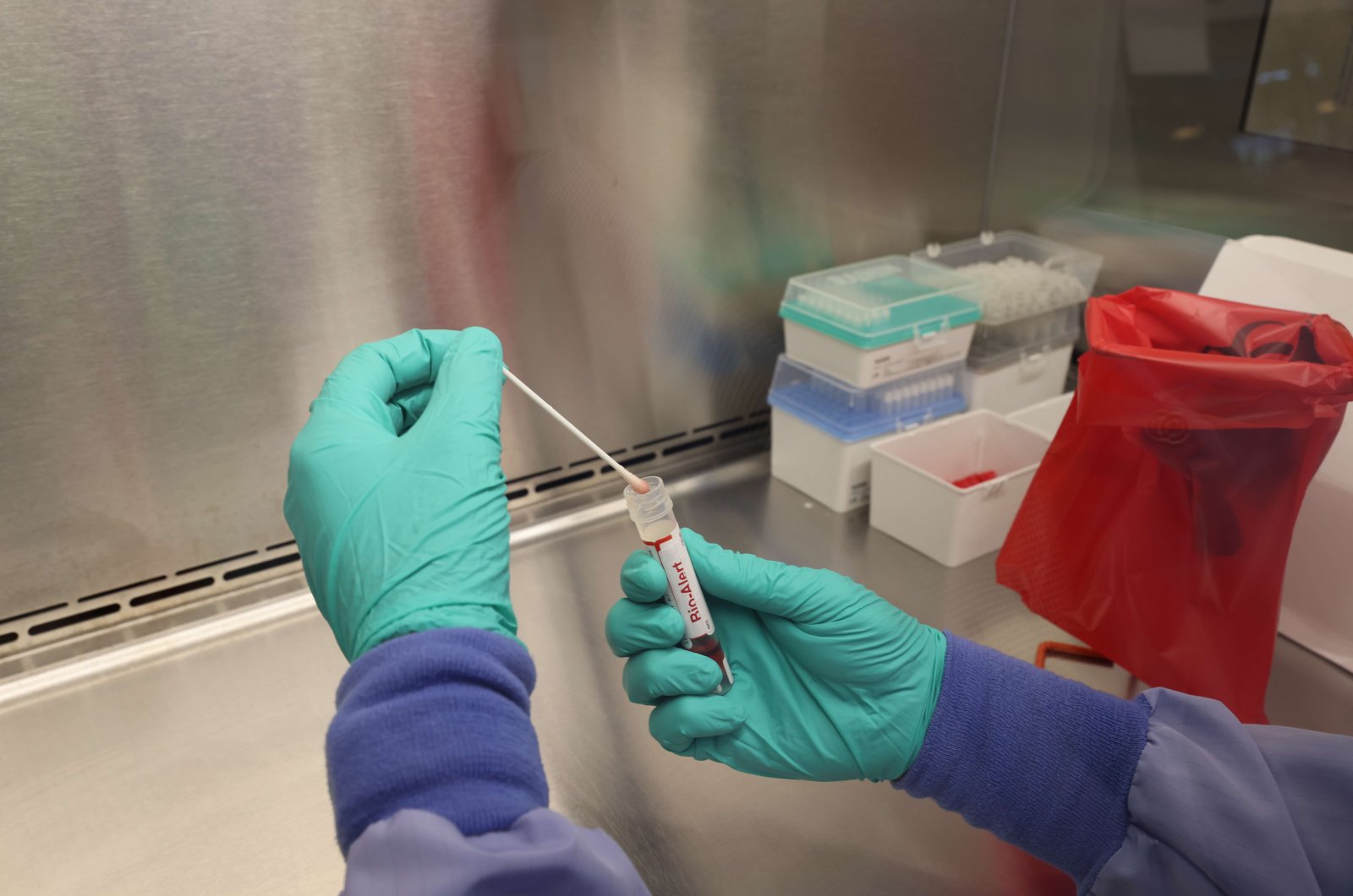 A swab that tested positive for the monkeypox virus is seen at the UW Medicine Virology Laboratory in Seattle, Washington, U.S., July 12, 2022. (AFP Photo)