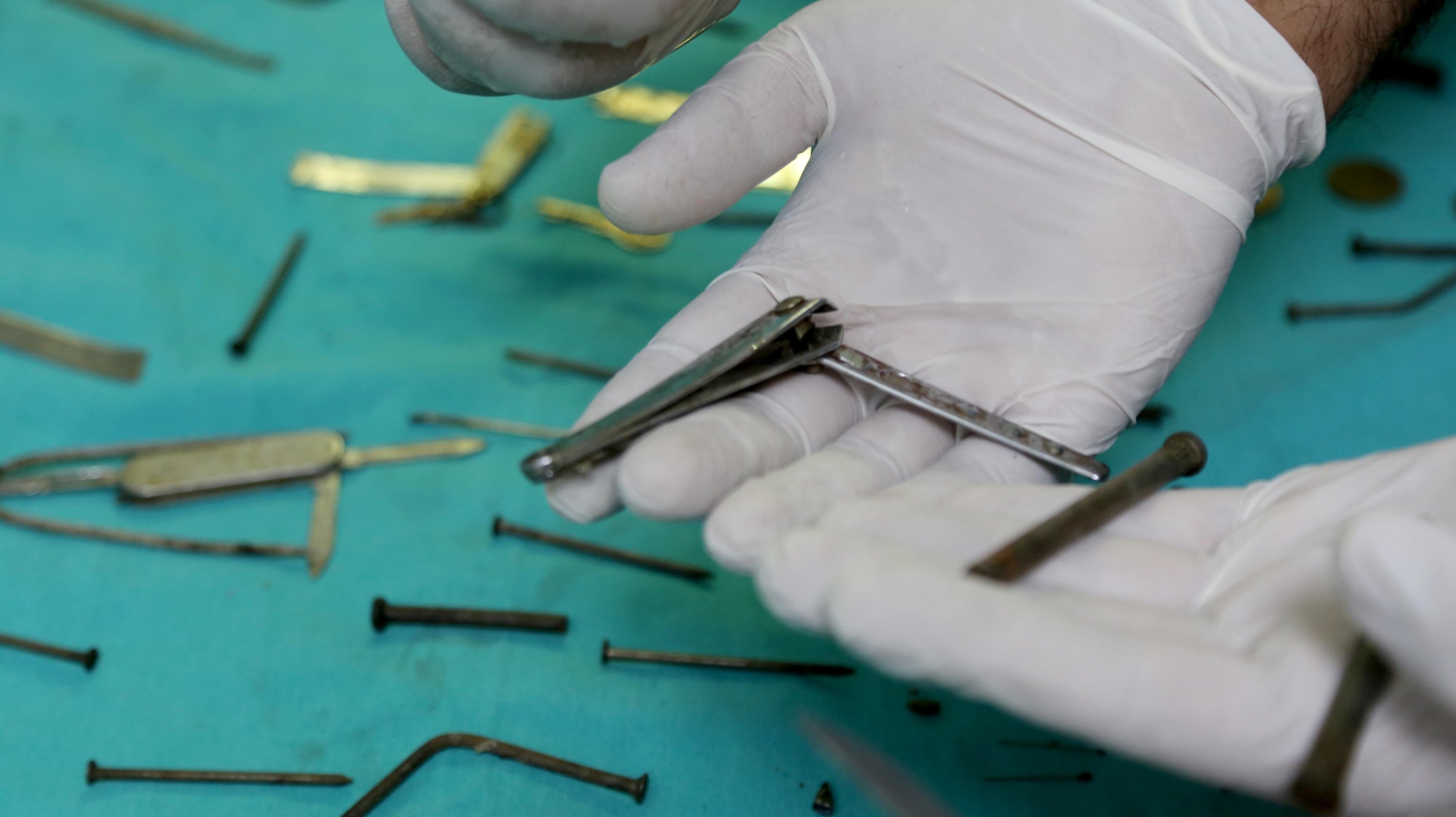 Seorang dokter memegang gunting kuku dan benda logam lainnya yang diambil dari perut wanita 24 tahun yang dilarikan ke rumah sakit karena sakit perut setelah menelan jarum di Van, Turki, 18 Juli 2022. (AA Photo)