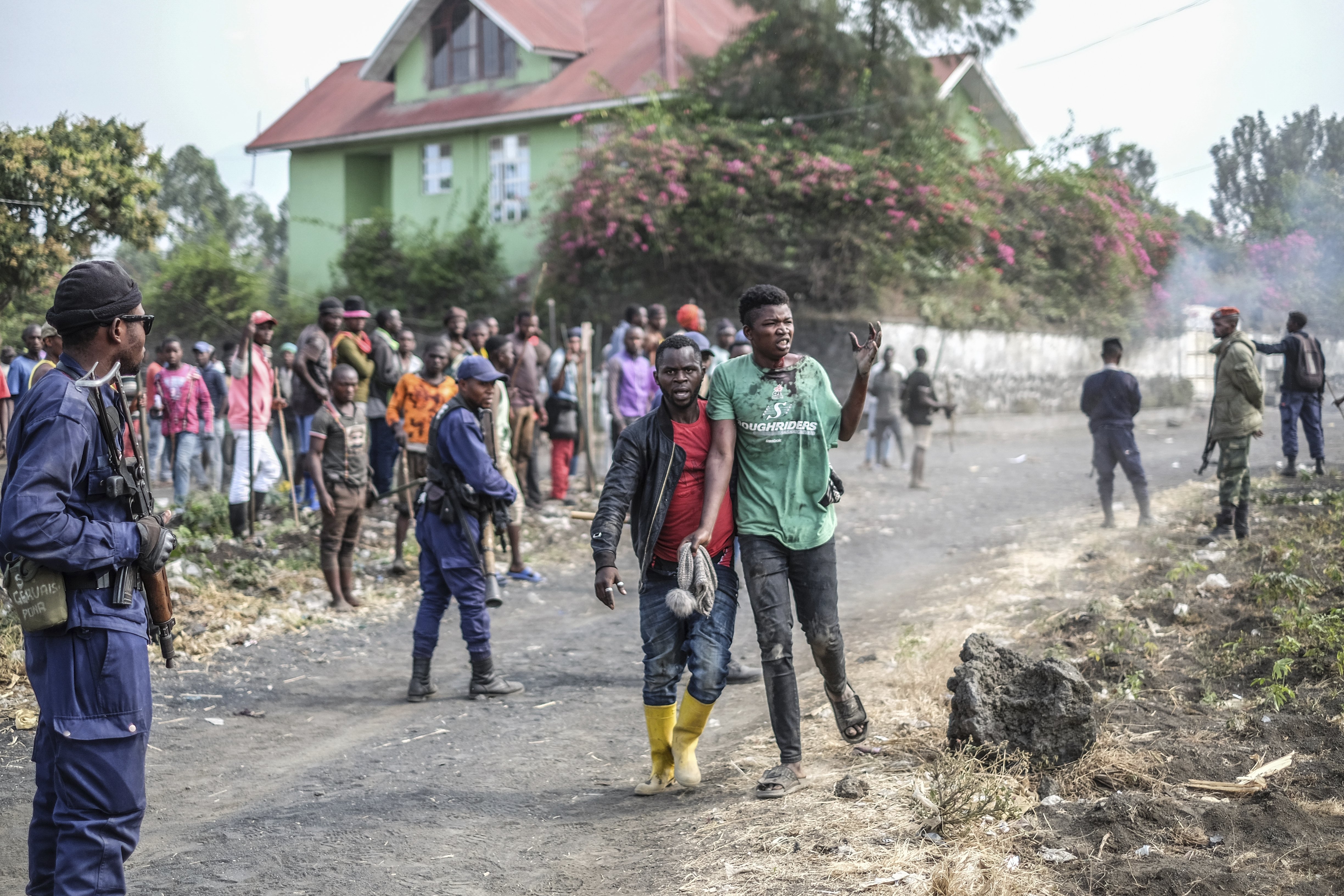 A wounded demonstrator walks past police officers during a protest against the United Nations peacekeeping force (MONUSCO) deployed in the Democratic Republic of the Congo in Sake, some 15 miles (24 kms) west of Goma, July 27, 2022. (AP Photo)