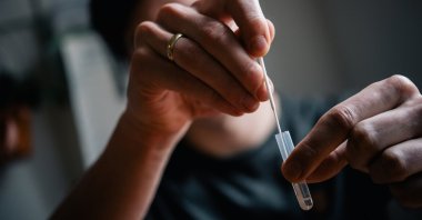 A COVID-19 self-test requires taking a swab sample from both nostrils. (DPA Photo)