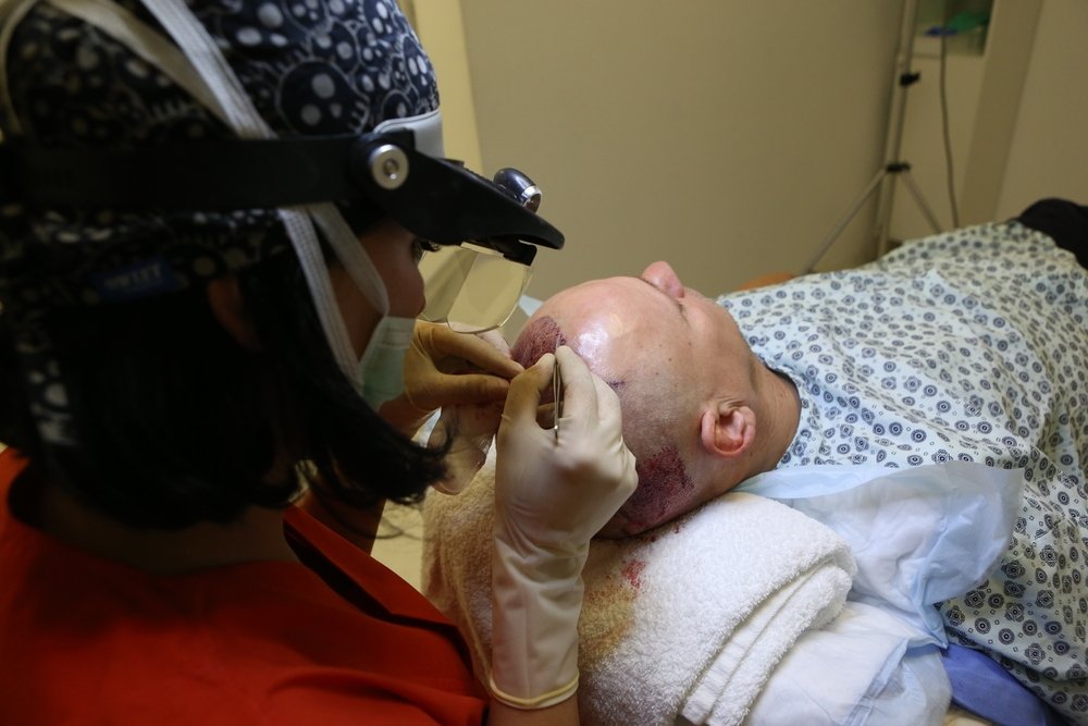 A man getting a hair transplant treatment in a clinic in Istanbul, Turkey, Dec. 4, 2014.