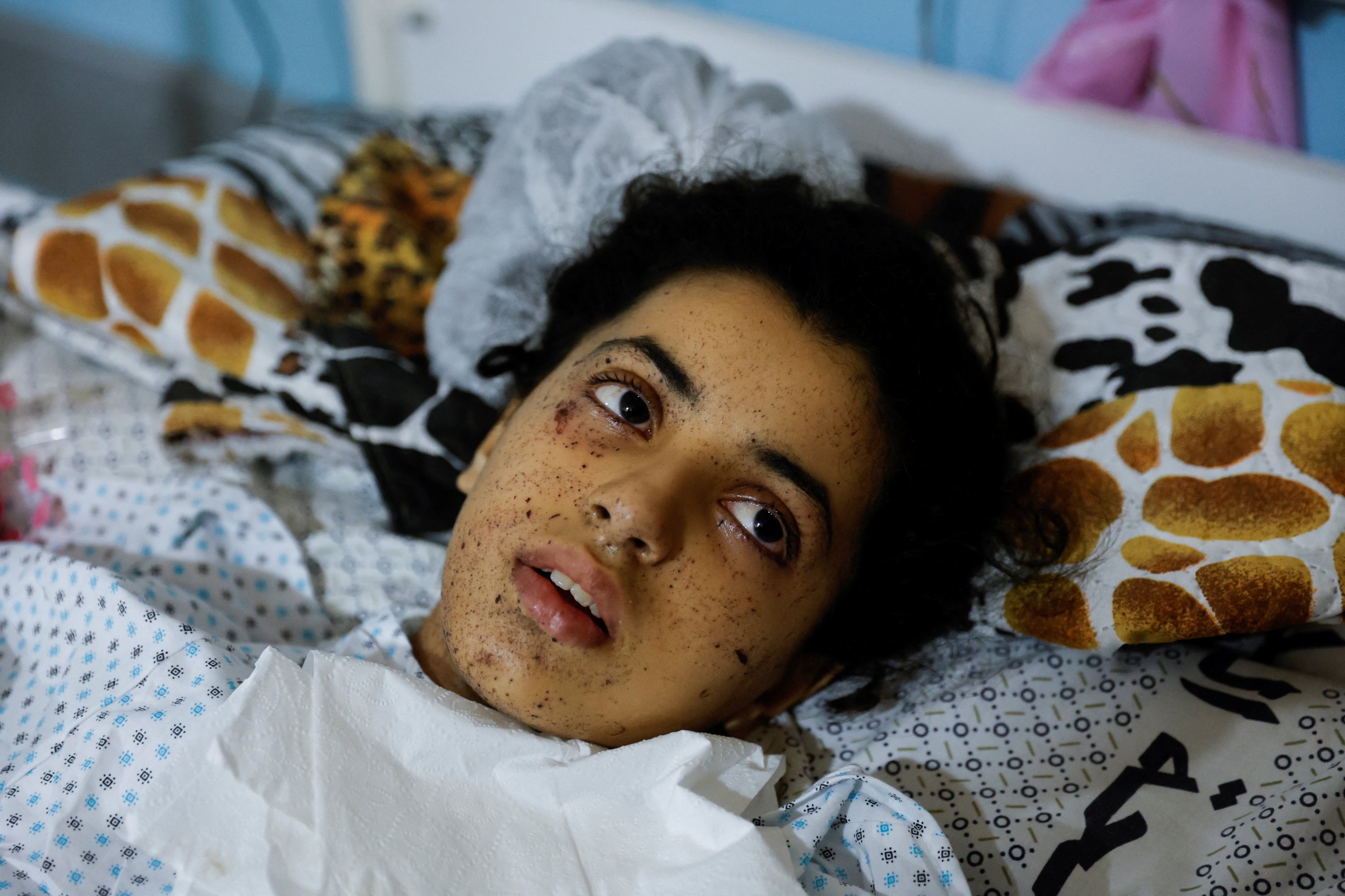 Gadis Palestina yang terluka Rahaf Salman, 11, yang kehilangan anggota tubuhnya setelah serangan Israel, terlihat saat dia berbaring di ranjang rumah sakit, saat gencatan senjata berlangsung, di Jalur Gaza utara 9 Agustus 2022. (Foto Reuters)