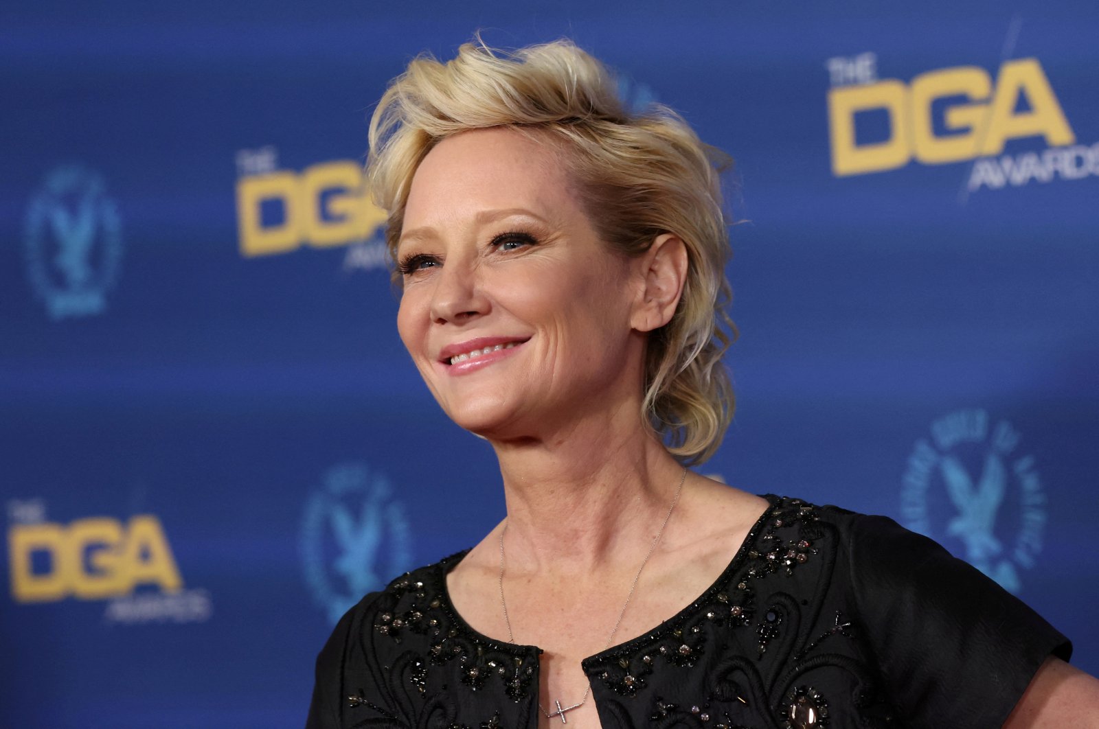 Anne Heche has been in a coma since the car accident and has lost consciousness
