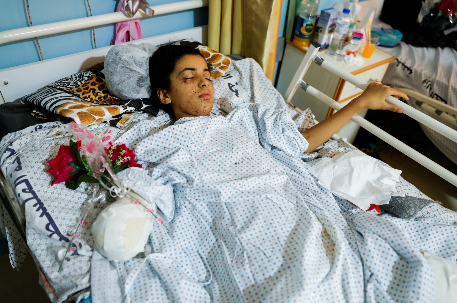 Wounded Palestinian girl Rahaf Salman, 11, who lost her limbs after an Israeli strike, looks on as she lies on a hospital bed, as cease-fire holds, in the northern Gaza Strip Aug. 9, 2022. (Reuters Photo)