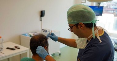 Dr. Ali Emre Karadeniz examines the head of a transplant recipient, in Istanbul, Türkiye, Aug. 14, 2022. (Photo by Mevlüt Hasgül)
