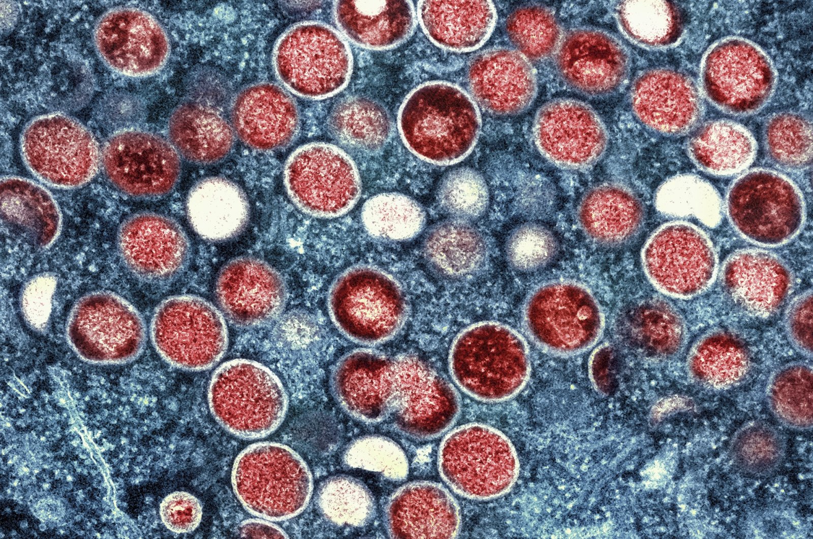 A colorized transmission electron micrograph of monkeypox particles (red) found within an infected cell (blue). (AP Photo)