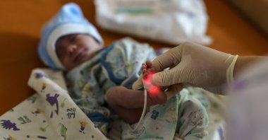Veronika, a baby born prematurely at 29 weeks, is checked at the Pokrovsk Perinatal Hospital, the only one under government control equipped to take care of premature babies, in Pokrovsk, Donetsk region, eastern Ukraine, Monday, Aug. 15, 2022. (AP Photo)