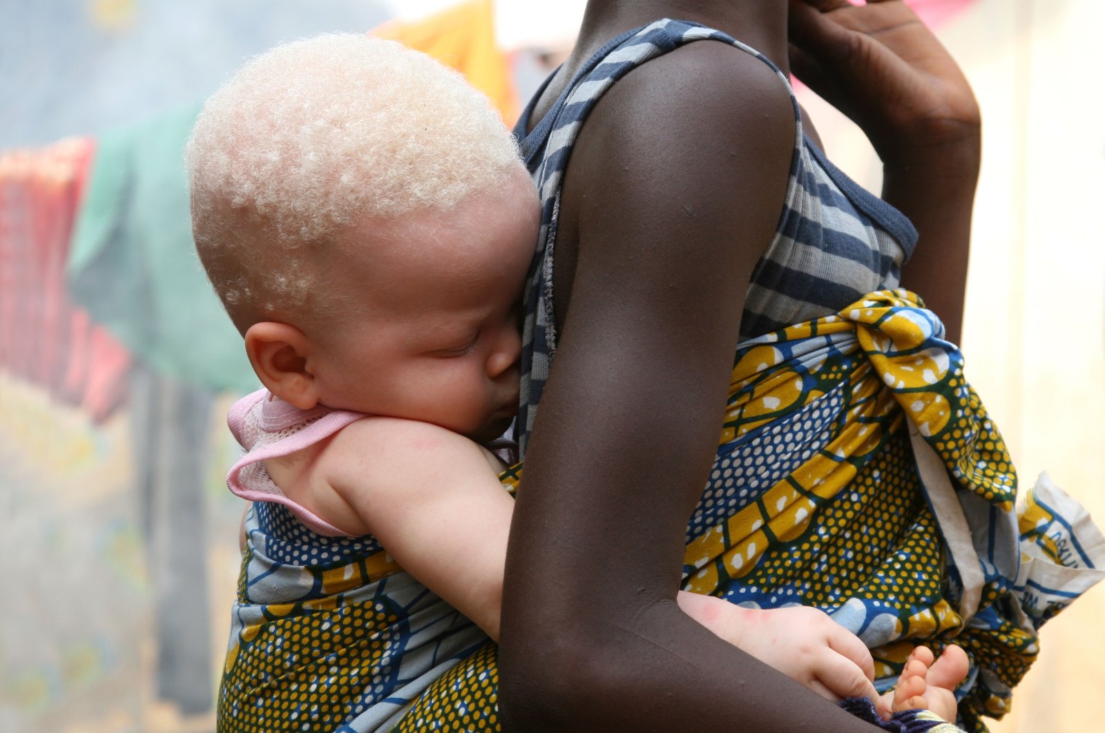 An albino baby sleeps in a sling on her sister&#039;s back in this undated picture, Sierra Leone, Africa. (Alamy via Reuters)