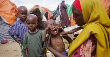 Maryan Madey, who fled the drought-stricken Lower Shabelle region, holds her malnourished daughter Deka Ali, 1, at a camp for the displaced on the outskirts of Mogadishu, Somalia, Sept. 3, 2022. (AP Photo)