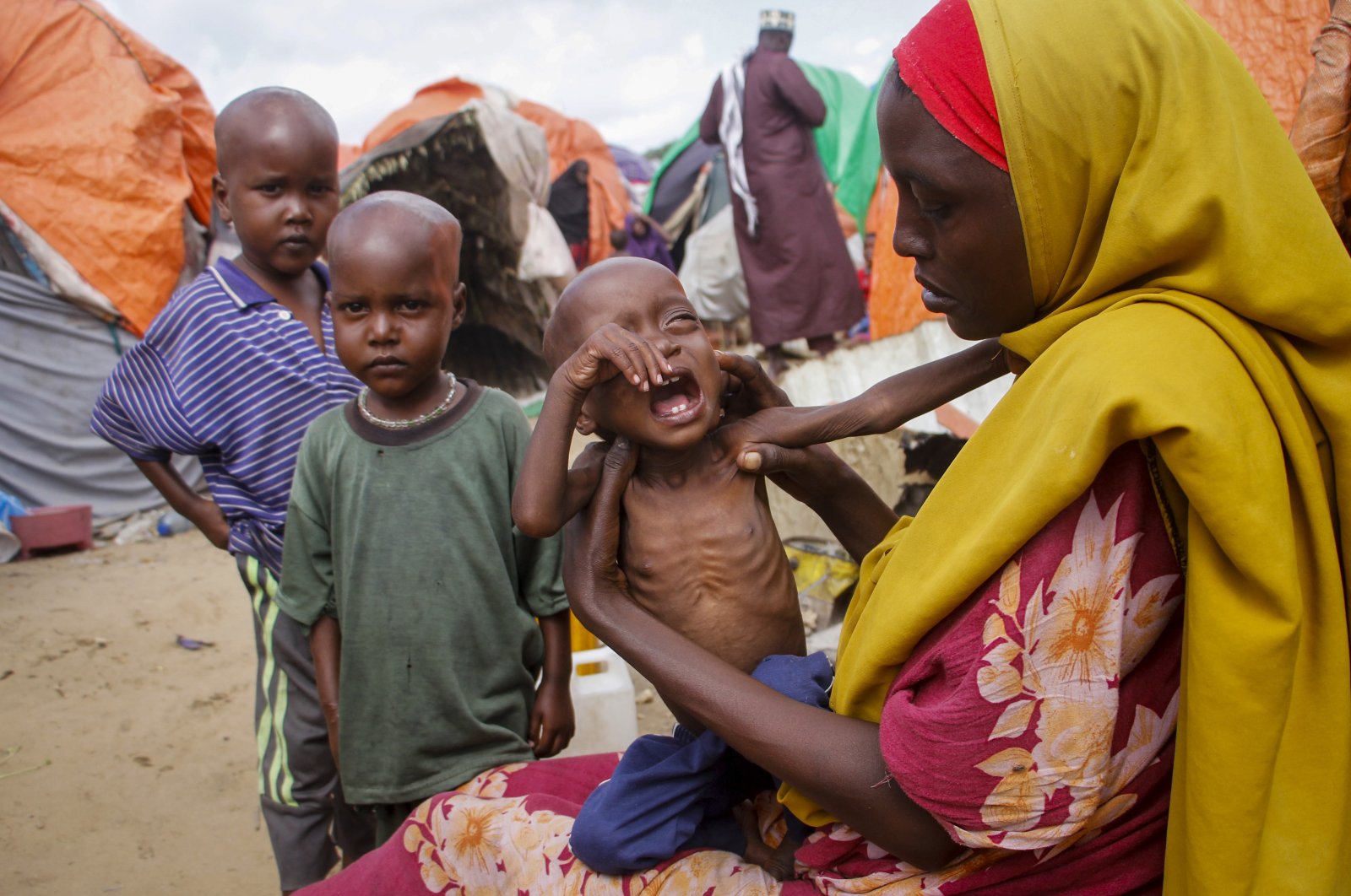 Maryan Madey, who fled the drought-stricken Lower Shabelle region, holds her malnourished daughter Deka Ali, 1, at a camp for the displaced on the outskirts of Mogadishu, Somalia, Sept. 3, 2022. (AP Photo)
