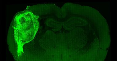 An undated handout picture released by Standford University on Oct. 12, 2022, shows the brain of a rat in which a fluorescent protein has been used to highlight transplanted human brain cells. (Photo by Sergiu PASCA / Stanford University / AFP)