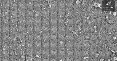 This undated image courtesy of Cortical Labs shows a Scanning Electron Microscope image of a neural culture that has been growing for more than six months on a high-density multi-electrode array. A few neural cells grow around the periphery and have developed complicated networks which cover the electrodes in the center. (Photo by Handout / AFP)