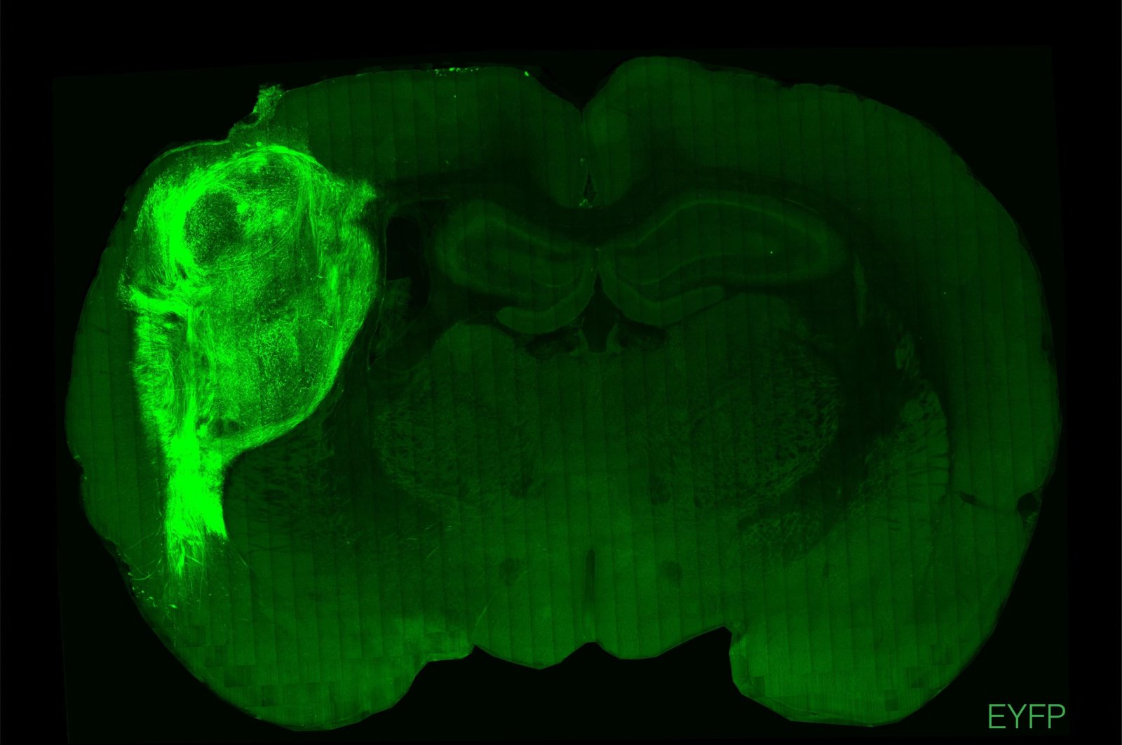 An undated handout picture released by Standford University on Oct. 12, 2022, shows the brain of a rat in which a fluorescent protein has been used to highlight transplanted human brain cells. (Photo by Sergiu PASCA / Stanford University / AFP)