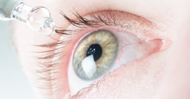 Your eyes are permeated by fine blood vessels, and it's almost unavoidable that one of them bursts. (dpa Photo)