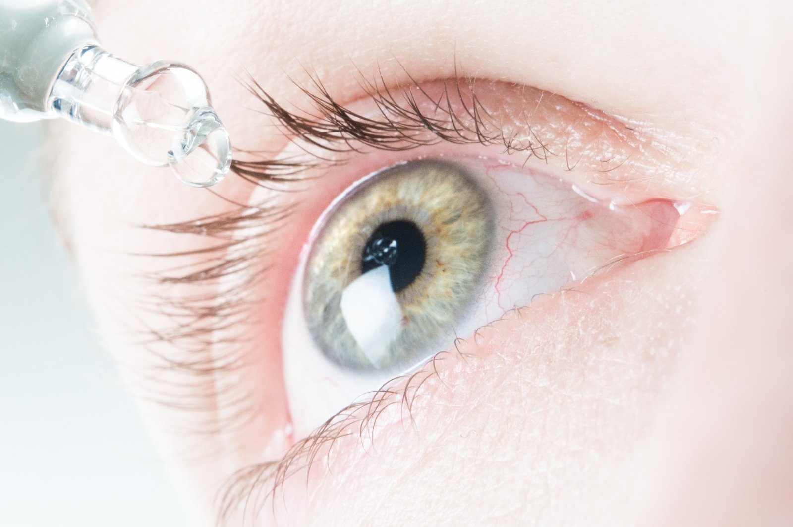 Your eyes are permeated by fine blood vessels, and it&#039;s almost unavoidable that one of them bursts. (dpa Photo)