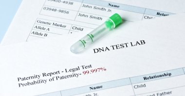 The Z.S. paternity case represents the first time Türkiye has managed to obtain a DNA sample from somebody living abroad to settle such a legal matter. (Shutterstock Photo)