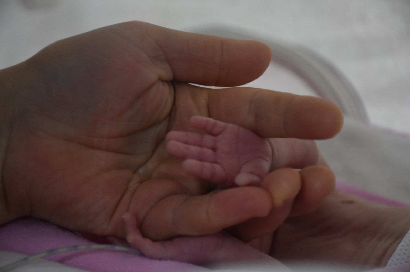 Türkiye melihat peningkatan kelahiran prematur