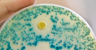 A laboratory employee holds an indicator culture plate for the detection of resistant bacteria, in Bavaria, Erlangen, Germany, July 21, 2015. (Getty Images Photo)