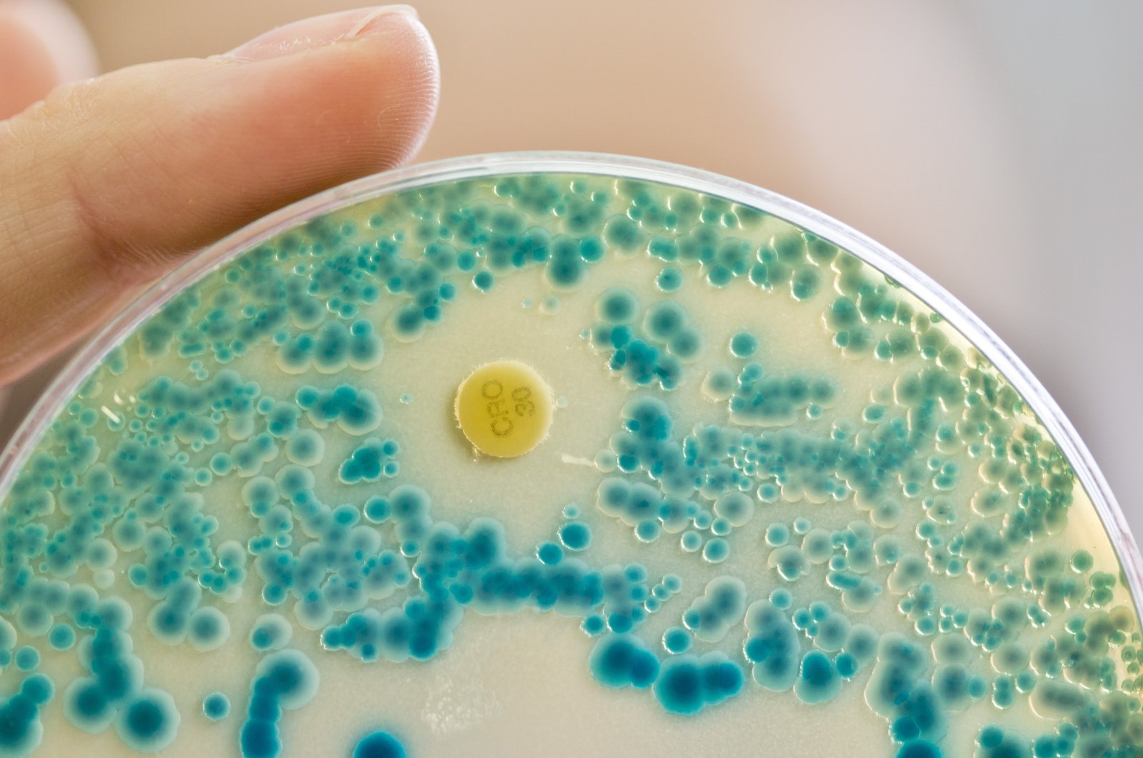A laboratory employee holds an indicator culture plate for the detection of resistant bacteria, in Bavaria, Erlangen, Germany, July 21, 2015. (Getty Images Photo)