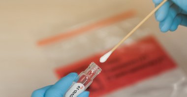 COVID-19 Nasal swab laboratory test in hospital lab. (Shutterstock Photo)