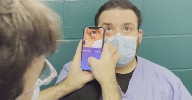 An artificial intelligence-supported application eMoglobin detects anemia levels in seconds, Dec. 11, 2022, (DHA Photo)