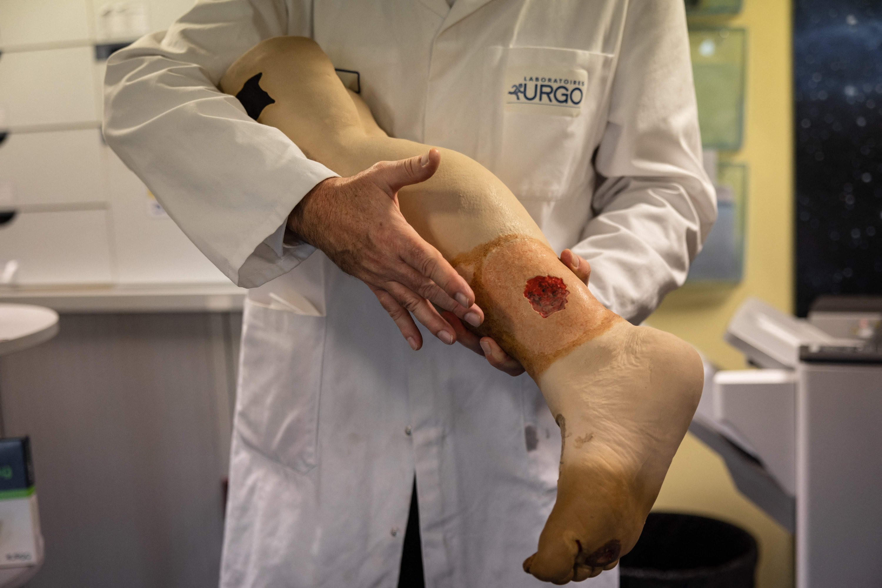 Bir çalışan, 16 Aralık 2022, Chenove, Fransa'daki Urgo tesisinde Fransız pansuman üreticisi tarafından geliştirilen suni deri ile tedavi edilebilecek ciddi yaraları gösteriyor. (AFP Fotoğrafı)