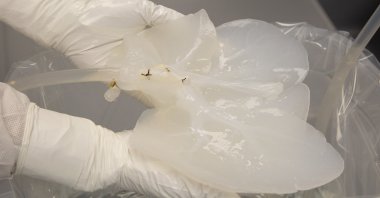 A pig liver that has been "decelled" is held by a technician in a Micromatrix laboratory, in Eden Prairie, Minnesota, U.S., Dec. 8, 2022. (AP Photo)