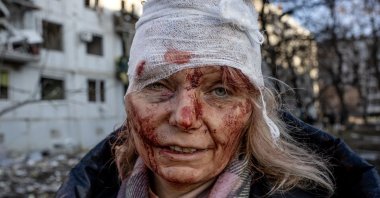 53-year-old teacher Olena Kurilo injured in Russian shelling of an apartment complex in Chuhuiv, Ukraine, Feb. 24, 2022. (AA Photo)