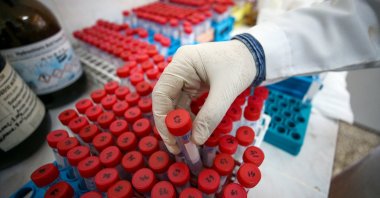 A researcher holds a sample taken from the Black Sea during the expedition, Ankara, Türkiye, Feb. 3, 2023. (AA Photo)