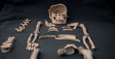 The remains of a woman found at an ancient cemetery discovered during the construction of a new project in Chapultepec Park in Mexico City, Mexico, Feb. 21, 2023. (AFP Photo)