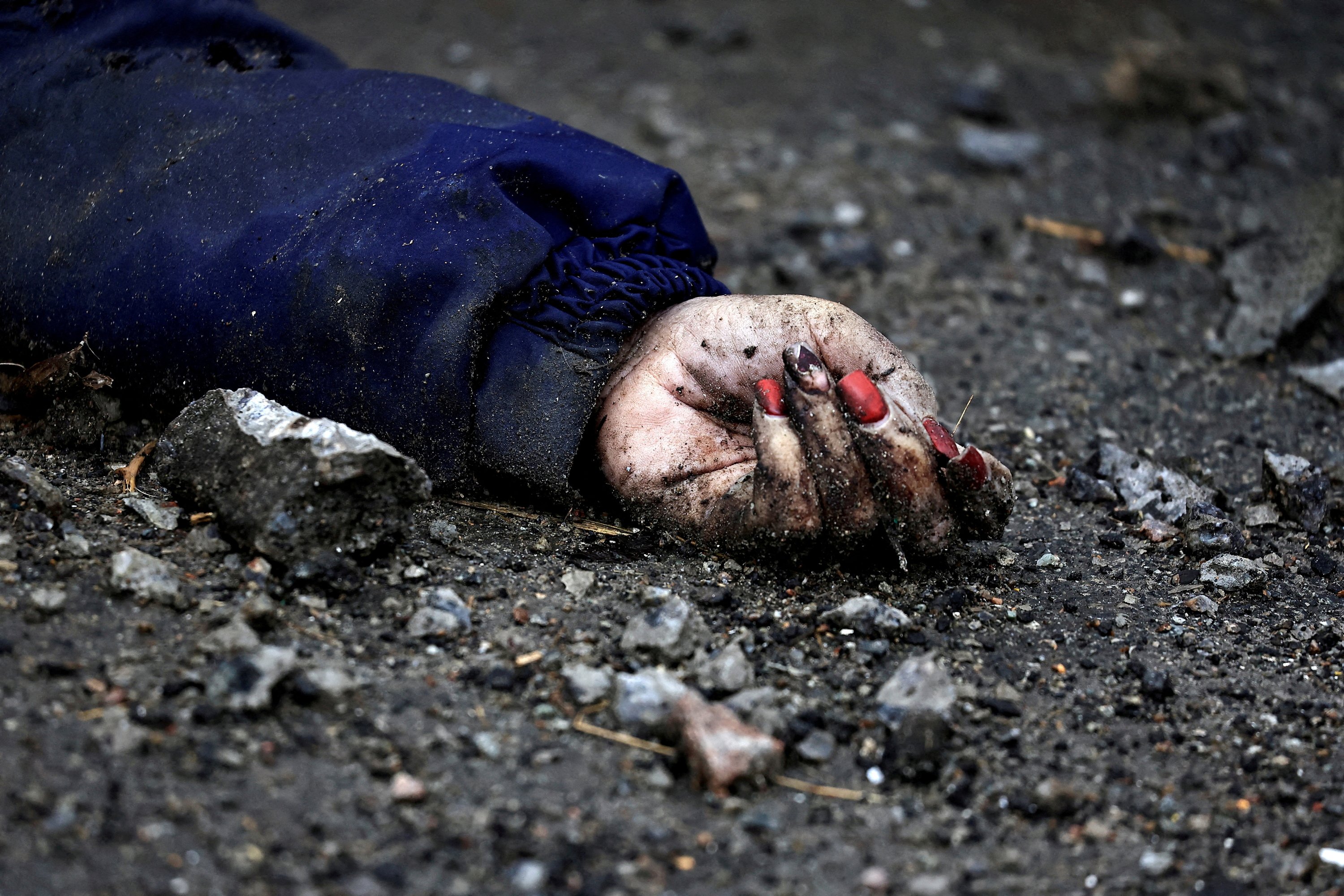 Tangan Iryna Filkina, perempuan yang menurut warga dibunuh oleh tentara tentara Rusia, digambarkan saat tubuhnya terbaring di jalan di Bucha, wilayah Kyiv, Ukraina, 2 April 2022. (Foto Reuters)