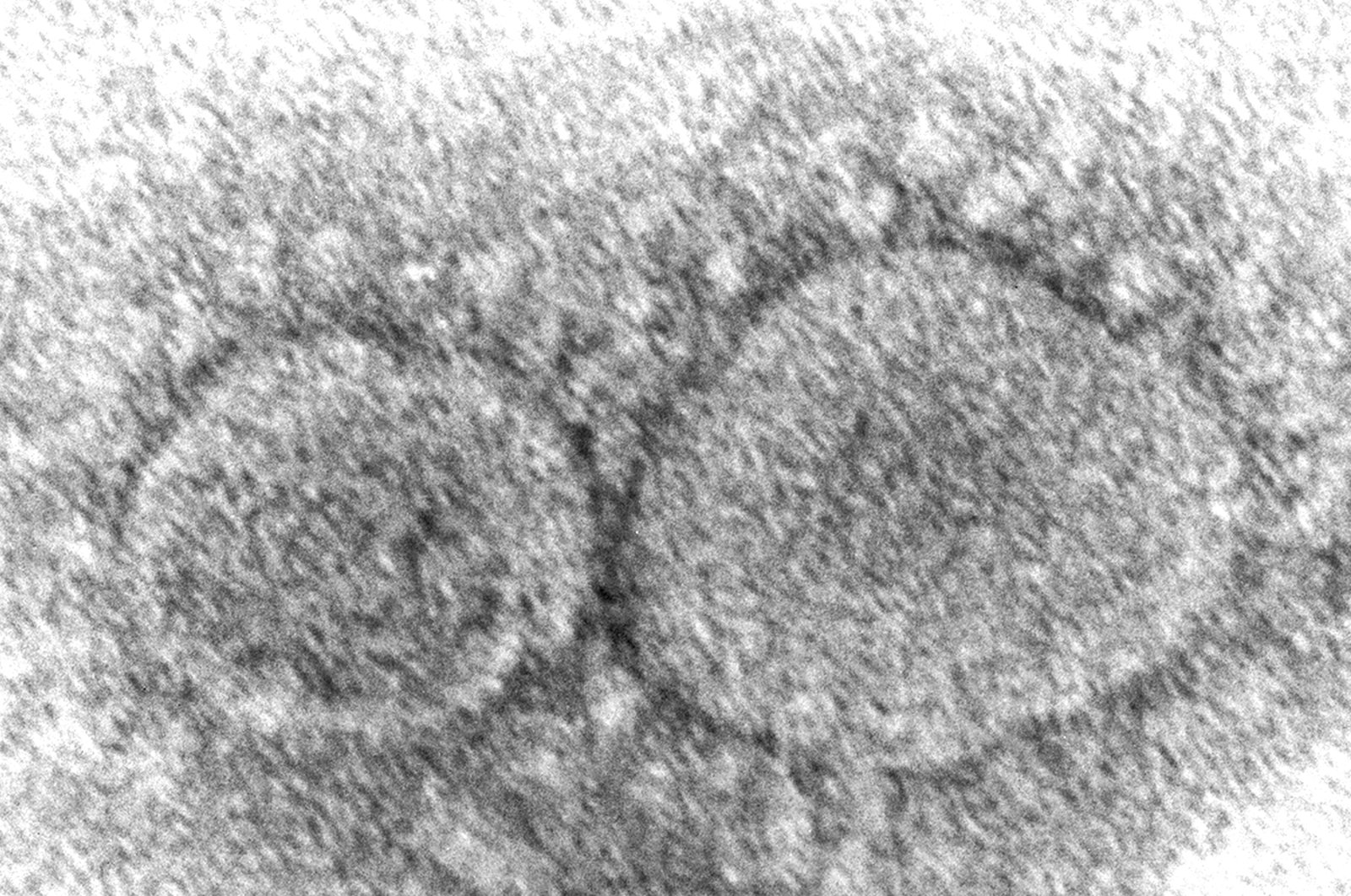 An electron microscope image shows SARS-CoV-2 virus particles. (AP Photo)