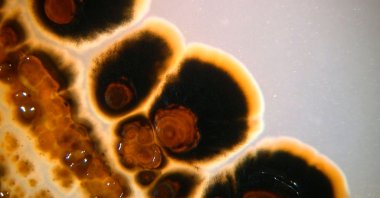 A microscope view of Salinispora tropica, a marine organism with potential to treat diseases such as cancer. (AFP Photo)