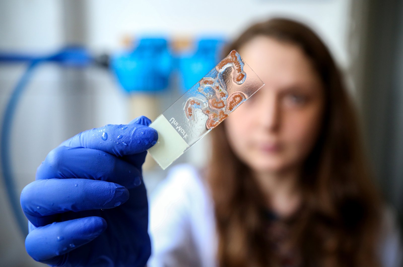 Samples of ascidians at ODTÜ University, in Ankara, Türkiye, April 7, 2023. (AA Photo)