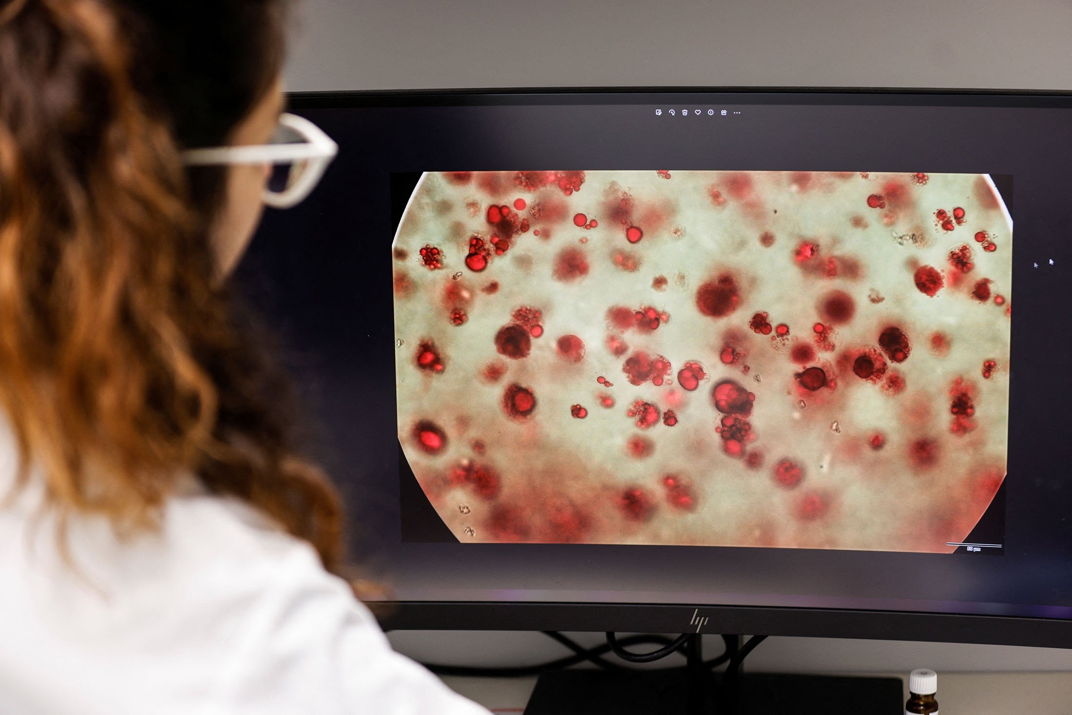 A worker inspects magnified species cells on a screen at the offices of Steakholder Foods in Rehovot, Israel, April 23, 2023. (Reuters Photo)