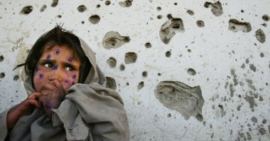 An Afghan child stands against a bullet-ridden wall as she waits to be seen at a health clinic in Kabul, Afghanistan, March 1, 2002. (Getty Images)