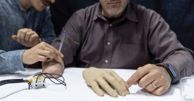 Fabrizio Fidati, who lost his right hand in an accident 25 years ago, points on a rubber hand where he feels on his phantom hand, in Geneva, Switzerland, April 19, 2023. (Reuters Photo)